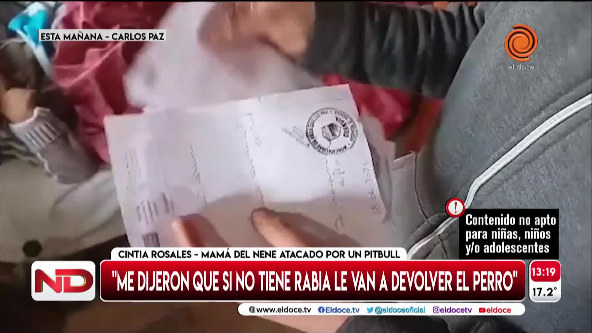 La salud del niño atacado por un pitbull en Carlos Paz