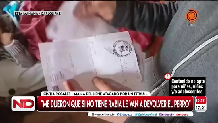 La salud del niño atacado por un pitbull en Carlos Paz