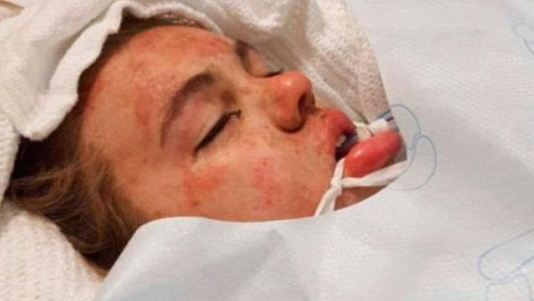 Impactantes fotos de una joven en coma tras consumir éxtasis