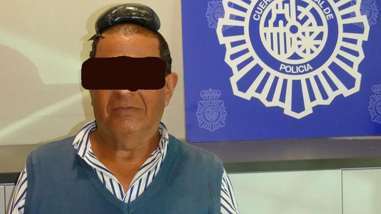 Insólito: lo detuvieron por llevar medio kilo de cocaína escondida en una peluca