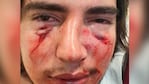 Insúa denunció haber sido atacado por dos jóvenes, pero para la Justicia él empezó la pelea y solo uno reaccionó.