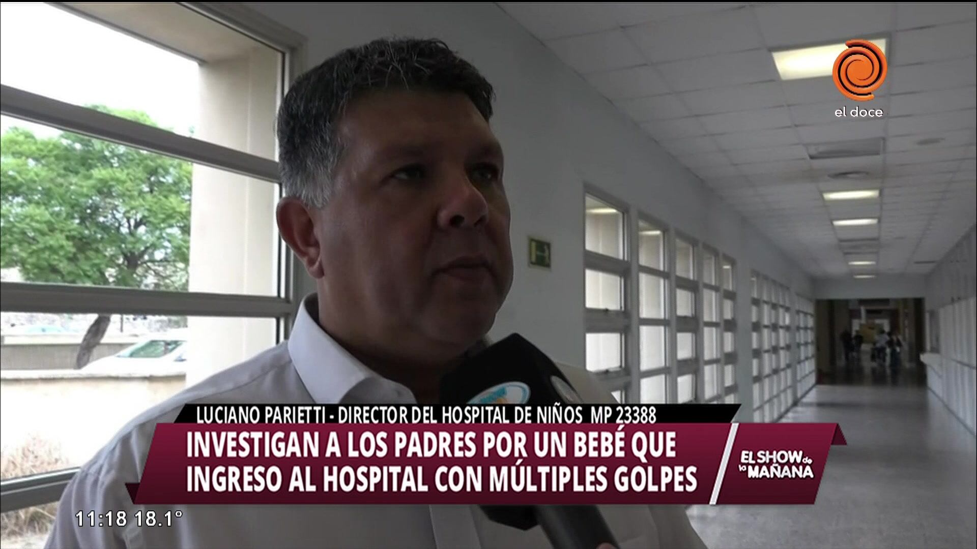 Investigan a padres de bebé golpeado