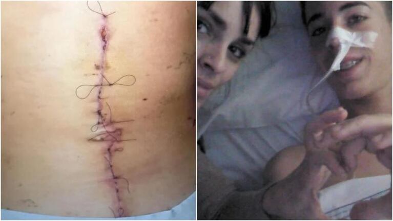 J Rei mostró una gran cicatriz en su cuerpo: la reacción de María Becerra