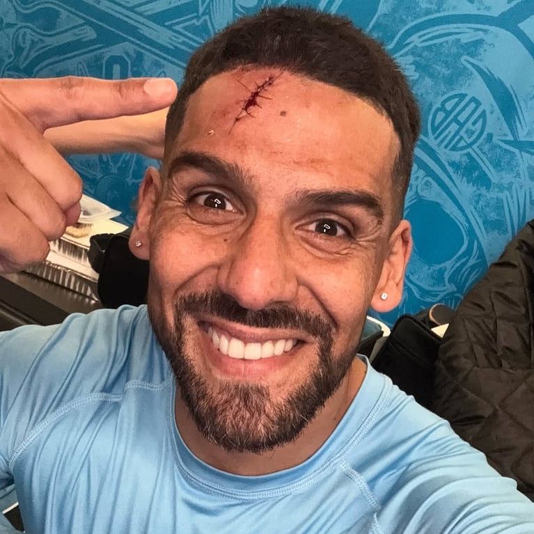 Jara sufrió un corte en la cabeza en el triunfo contra Banfield.