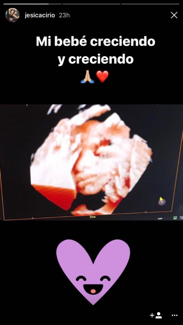 Jésica Cirio presentó a su “beba movediza” en la ecografía 4D