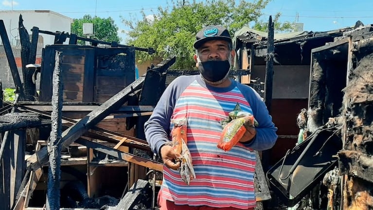 Jesús González necesita ayuda tras el incendio. Foto: Julieta Pelayo / El Doce