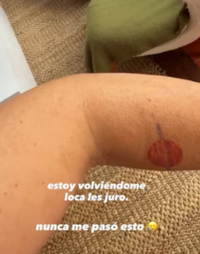 Jimena Barón reveló que sufre de una enfermedad hace un mes: “Es enloquecedor”