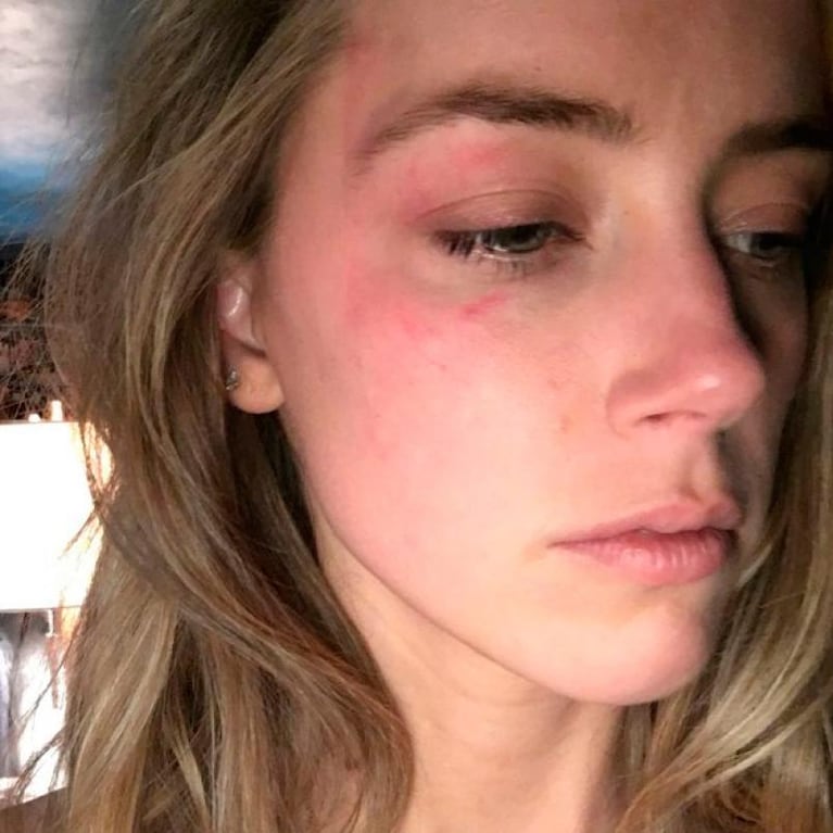 Johnny Depp fue denunciado por golpear a su esposa