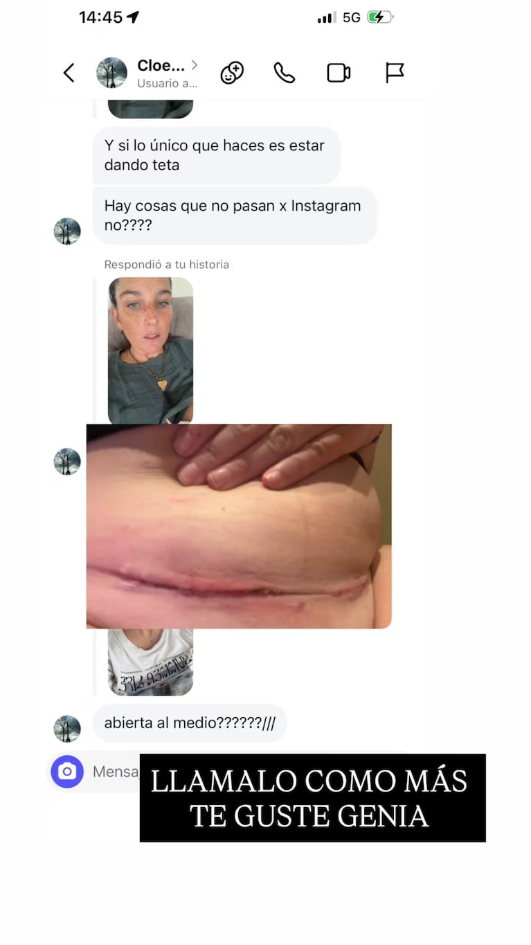 Juana Repetto estalló contra una seguidora y mostró una impresionante foto de su cesárea: “Genia”