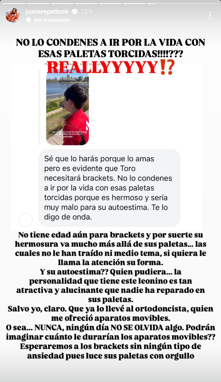 Juana Repetto le contestó a una seguidora que criticó los dientes de su hijo. (Foto: Instagram/juanarepettook)
