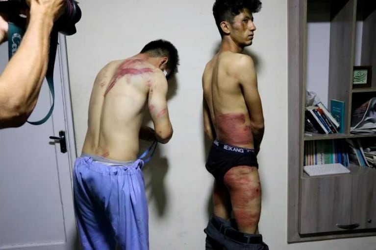 Kabul: los talibanes golpearon brutalmente a dos periodistas que cubrían una manifestación