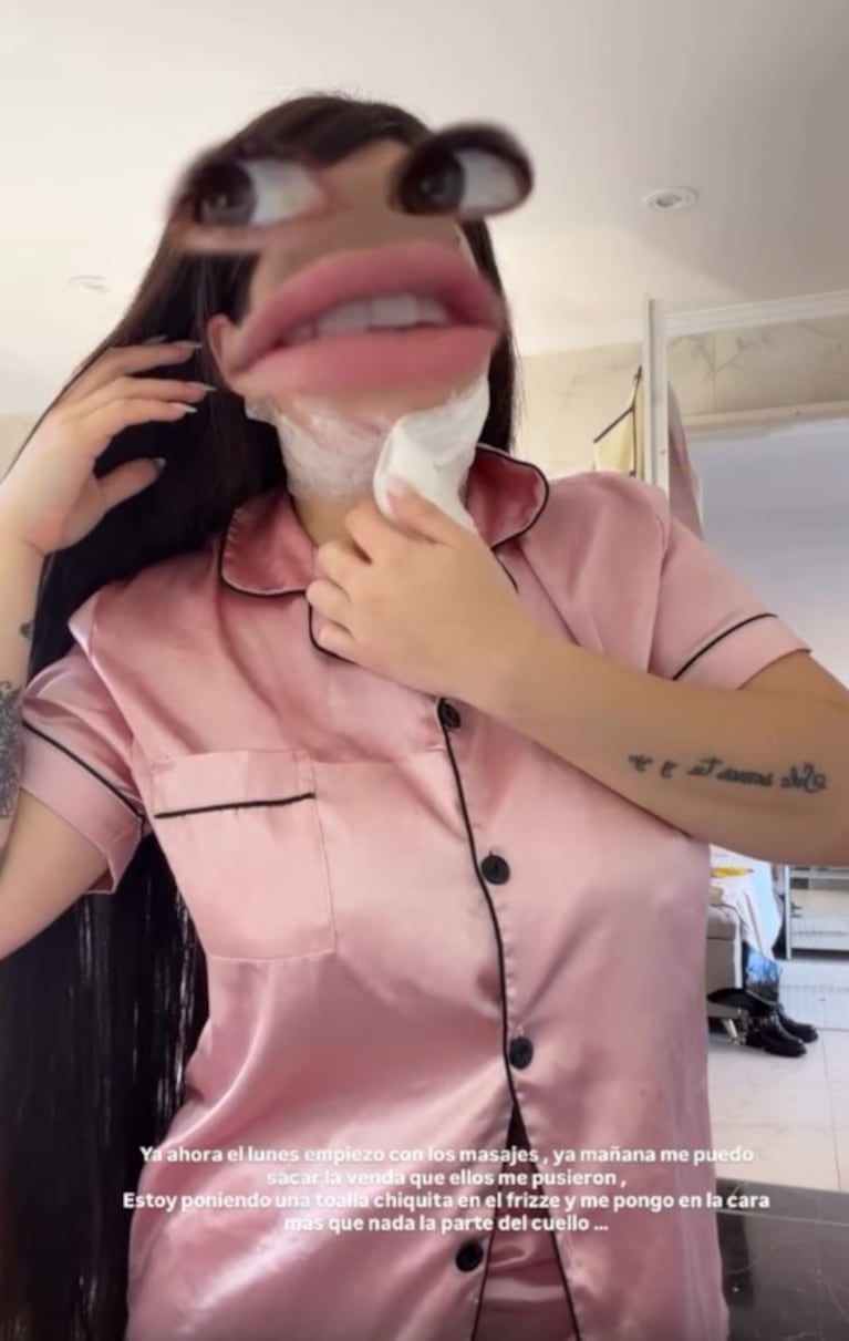 Kami Franco mostró el resultado de una nueva cirugía estética y en las redes le dijeron de todo