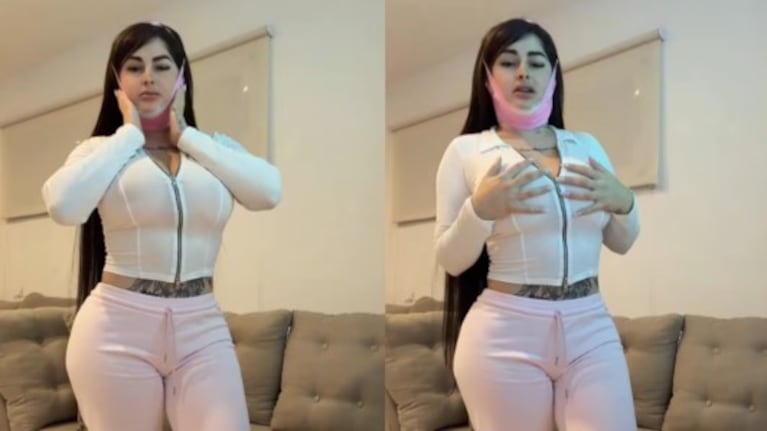 Kami Franco mostró el resultado de una nueva cirugía estética y en las redes le dijeron de todo