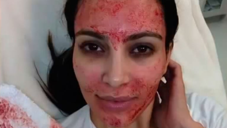 Kim Kardashian se sometió a este excéntrico tratamiento facial.