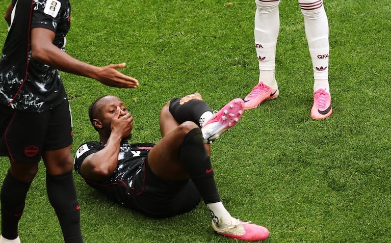 Koné quedó en boca de todos tras sufrir una durísima lesión en el Mundial.