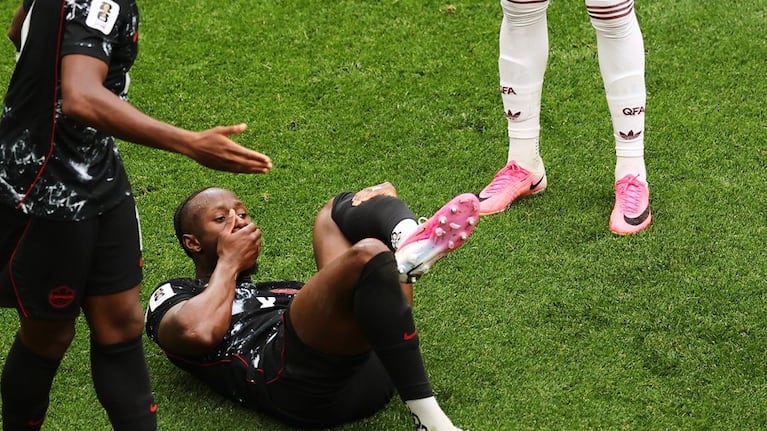 Koné quedó en boca de todos tras sufrir una durísima lesión en el Mundial.