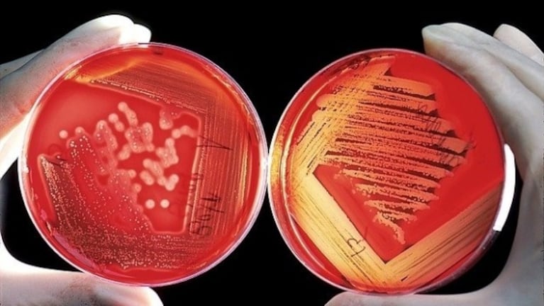 La bacteria fue fatal para cinco pacientes y hay otros internados.