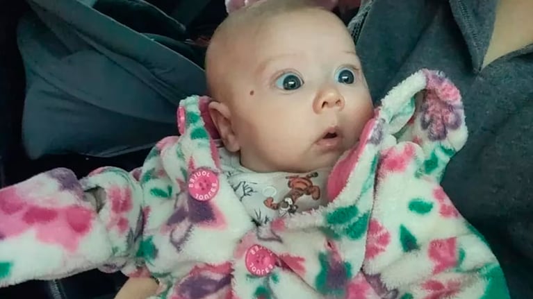 La beba tiene 10 meses y ya fue operada dos veces.