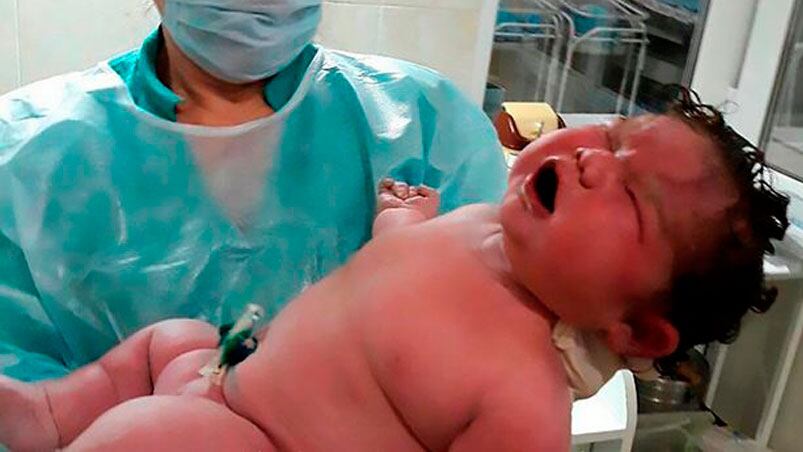 La bebé gigante que sorprendió a Rusia.