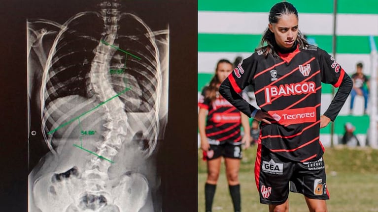 La desviación en la columna de María Luz, que volvió a jugar en Instituto.