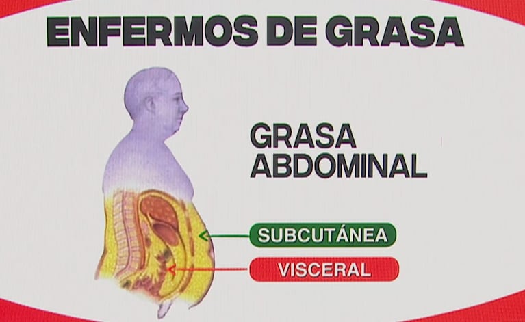 La diferencia entre la grasa subcutánea y la visceral.