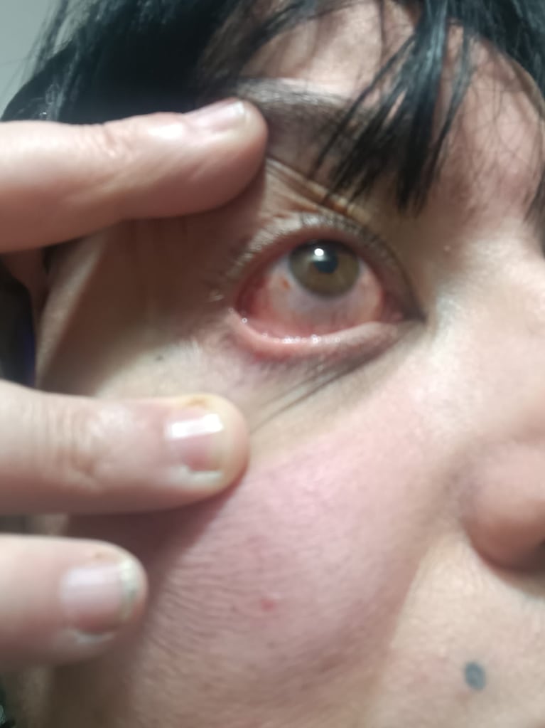 La doctora sufrió un golpe de puño en el ojo.