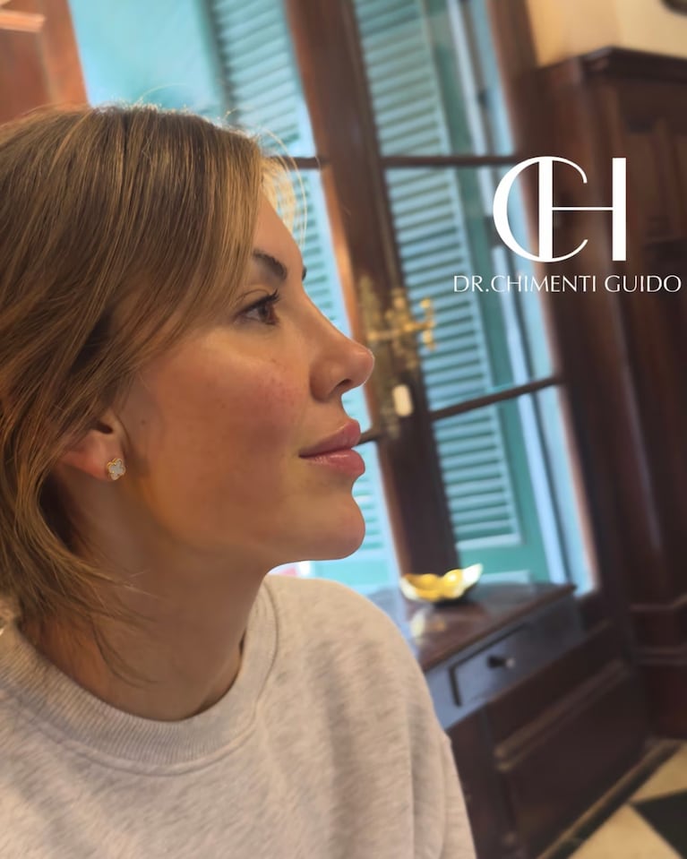La esposa de Lisandro Martínez se retocó el rostro y sorprendió al mostrar el resultado