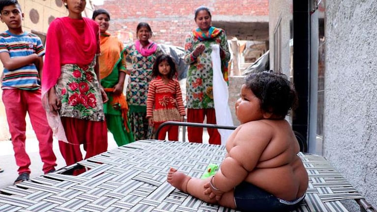 La extraña condición de una beba de ocho meses que pesa 17 kilos