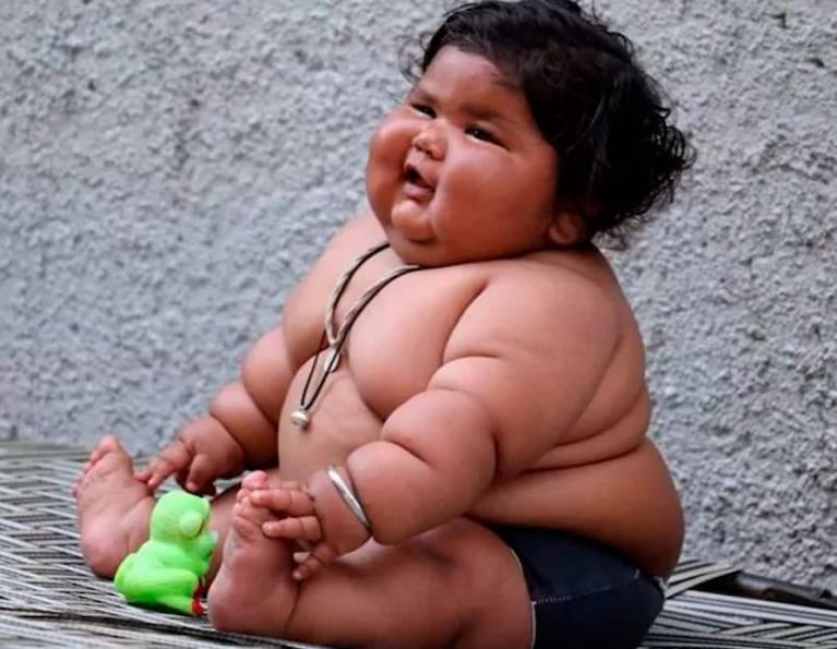 La extraña condición de una beba de ocho meses que pesa 17 kilos