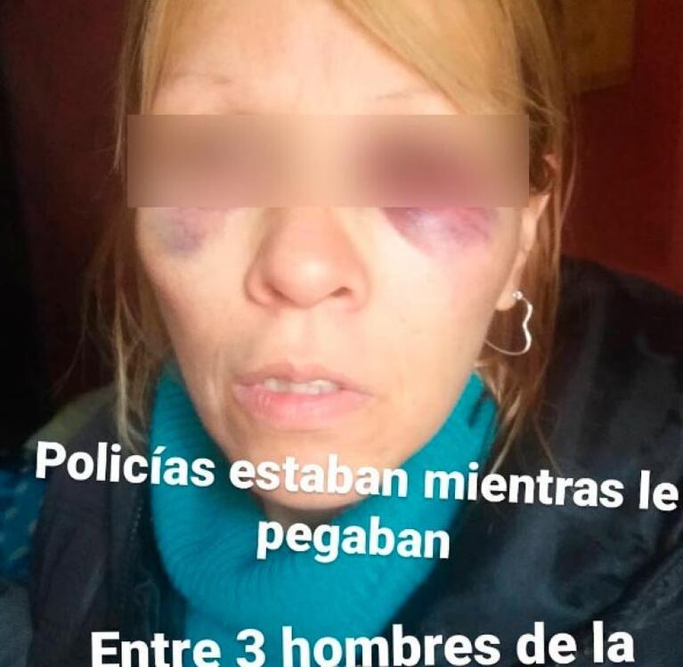 La Falda: tres hombres golpearon a una mujer por un cigarrillo