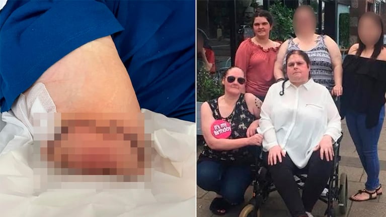 La familia de Lorraine exige respuestas de los médicos que la atendieron.