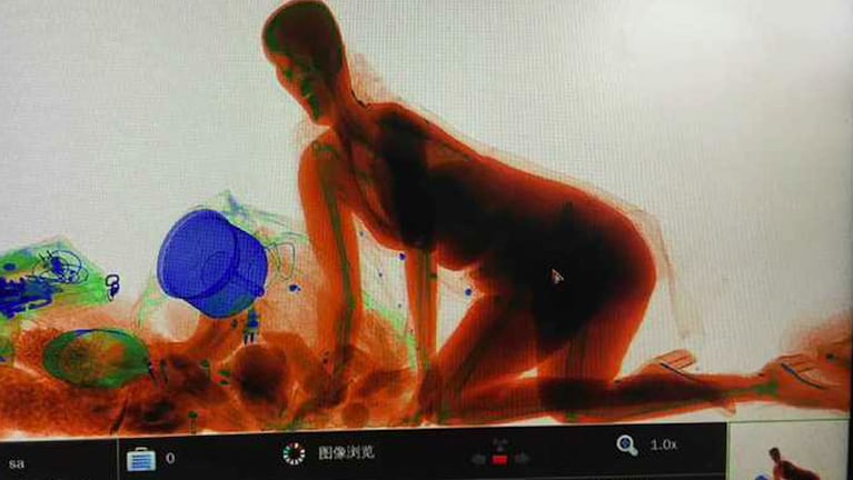 La imagen de la mujer dentro del escáner en China.