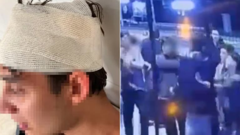 La imagen del joven agredido luego de la golpiza.