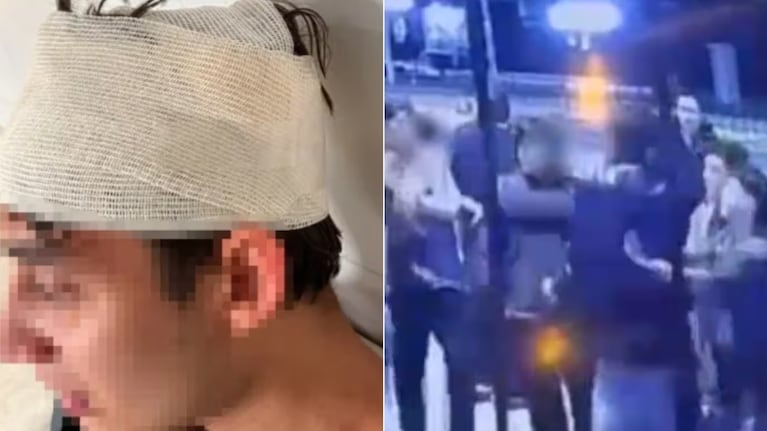 La imagen del joven agredido luego de la golpiza.