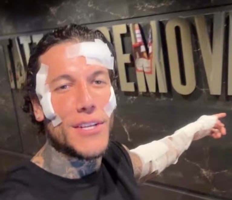 La imagen que compartió Alex tras sacarse los tatuajes.