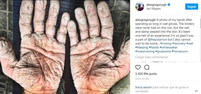 La impactante foto de las manos arruinadas de un expedicionario