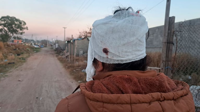 La joven aún tiene la bala alojada en la cabeza. Foto: Juan Pablo Lavisse / ElDoce.tv