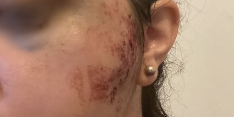 La joven de 27 años iba sentada en un asiento contra la ventanilla.