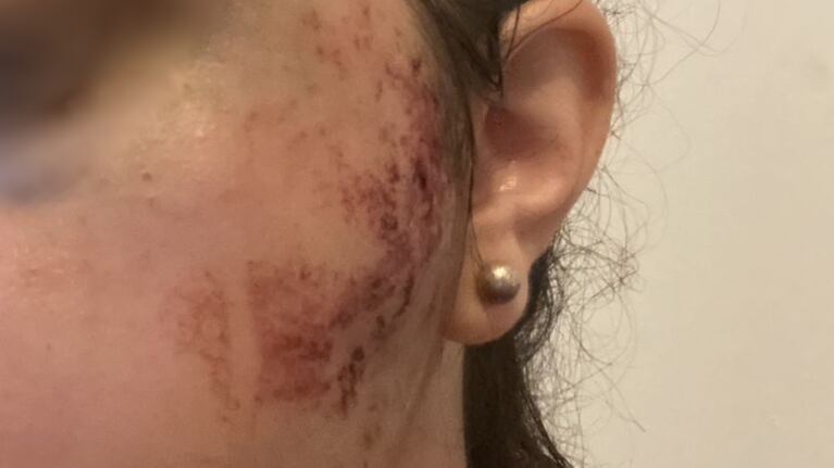La joven de 27 años iba sentada en un asiento contra la ventanilla.