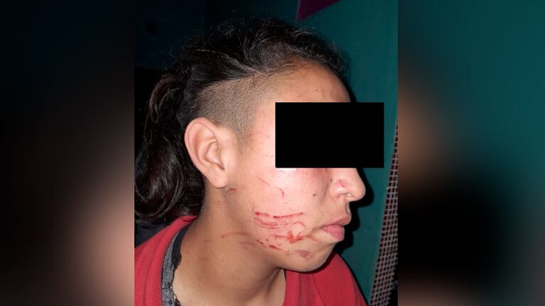 La joven tiene 16 años y juega al fútbol.