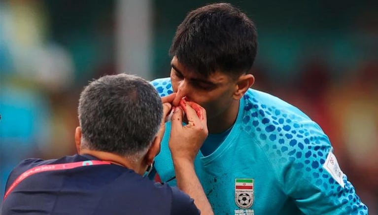 La lesión del arquero iraní tras el tremendo choque en el partido contra Inglaterra