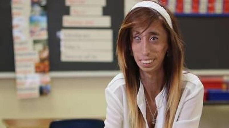 La lucha de Lizzie Velasquez contada en un documental