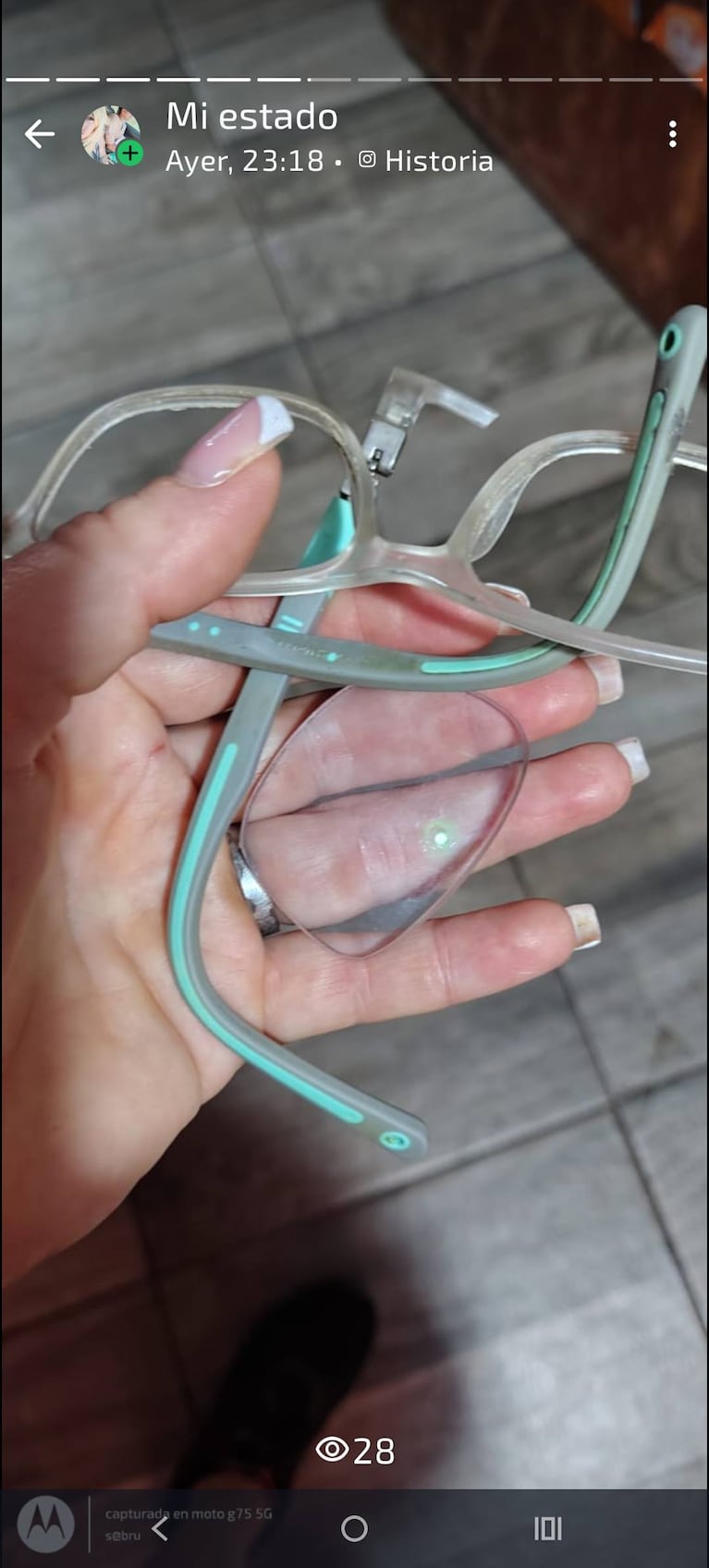 La madre publicó en su estado los anteojos rotos del nene tras el ataque.