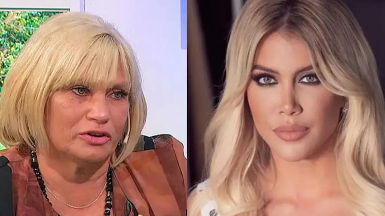 La mamá de L-Gante se hizo tratamientos y aseguran que un detalle la dejó igual a Wanda Nara