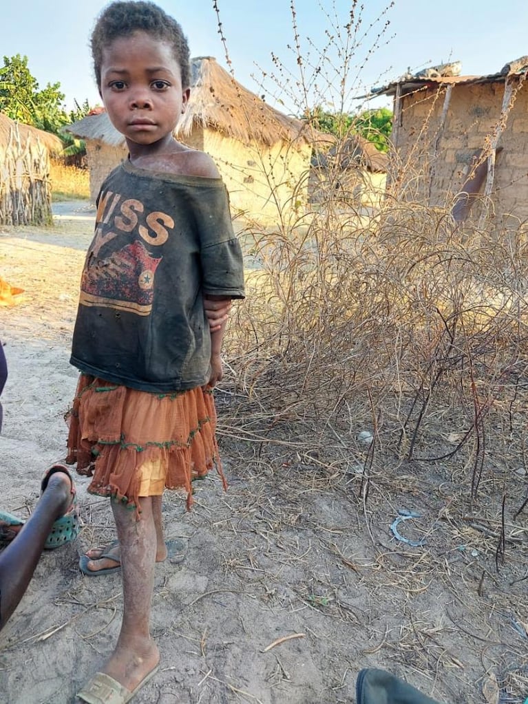 La médica cordobesa en Angola: “Jamás imaginé que existía este nivel de deshumanización”