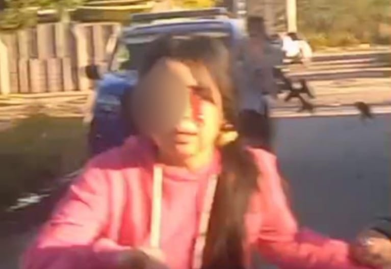 La menor perdió el ojo tras un disparo de arma no letal de la Policía.