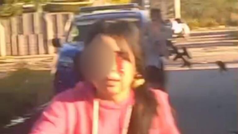 La menor perdió el ojo tras un disparo de arma no letal de la Policía.
