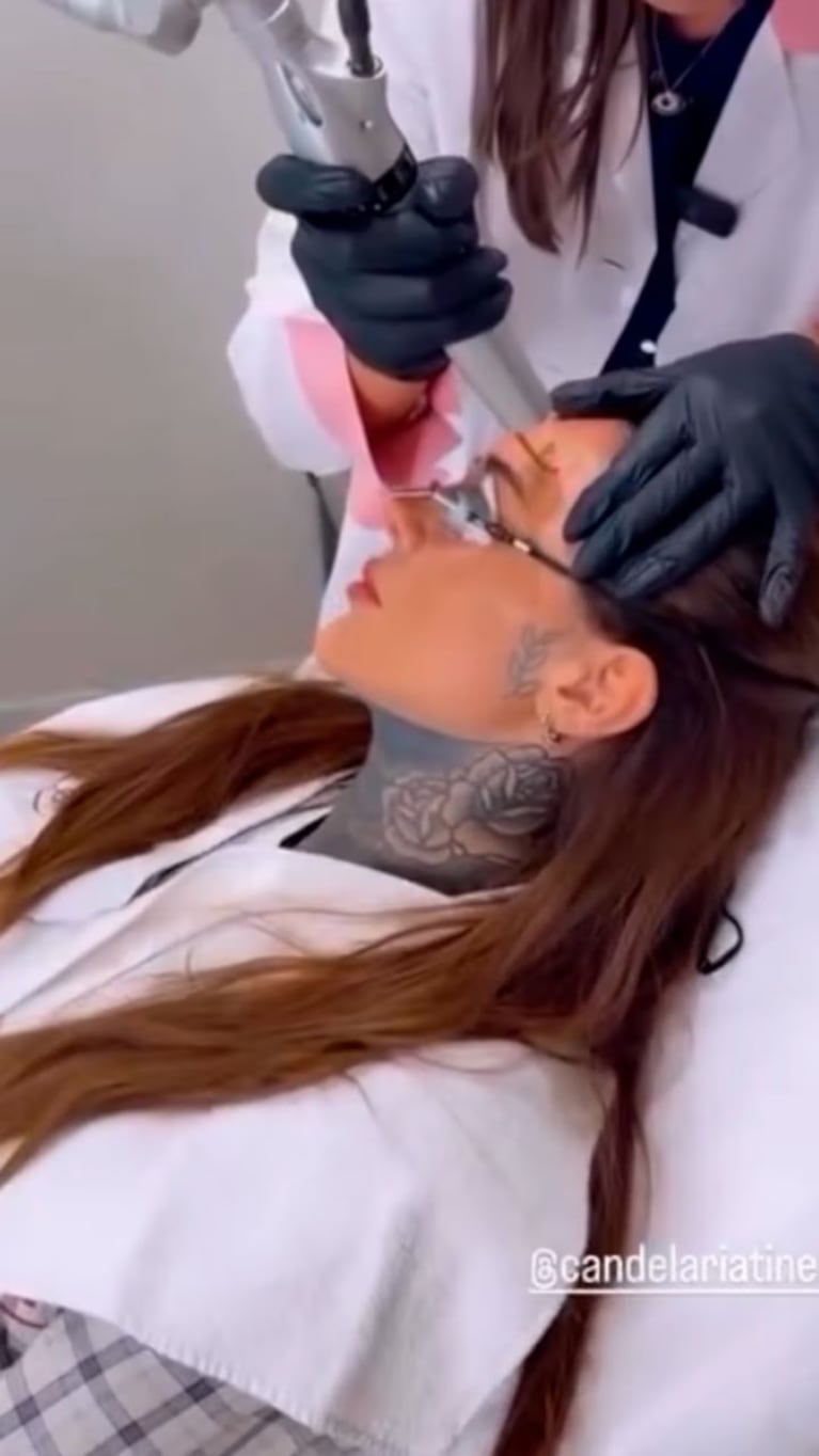 La modelo empezó el proceso para borrarse a Hello Kitty del rostro.