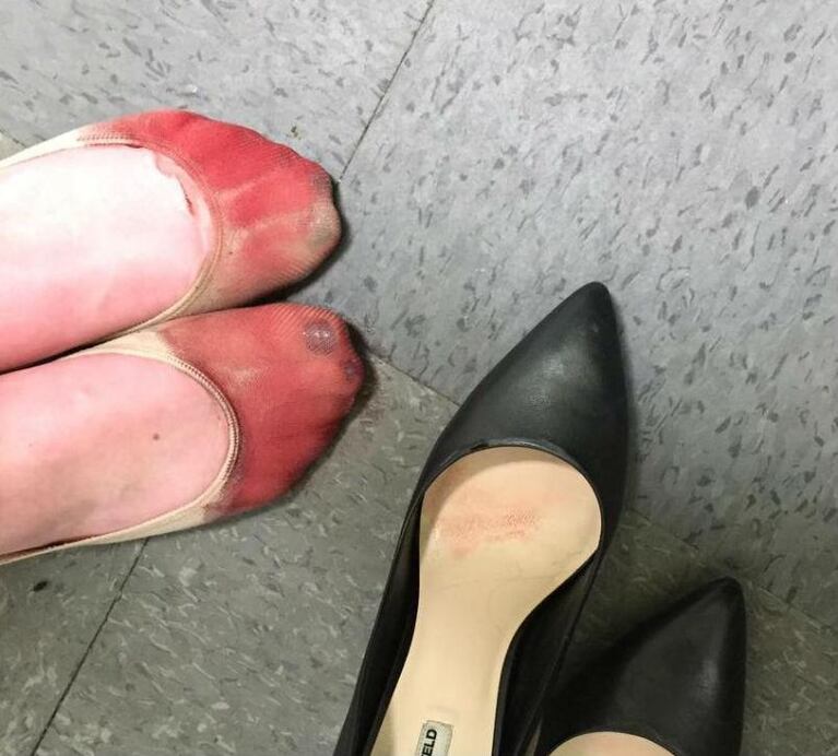 La moza de los pies sangrantes conmueve a las redes