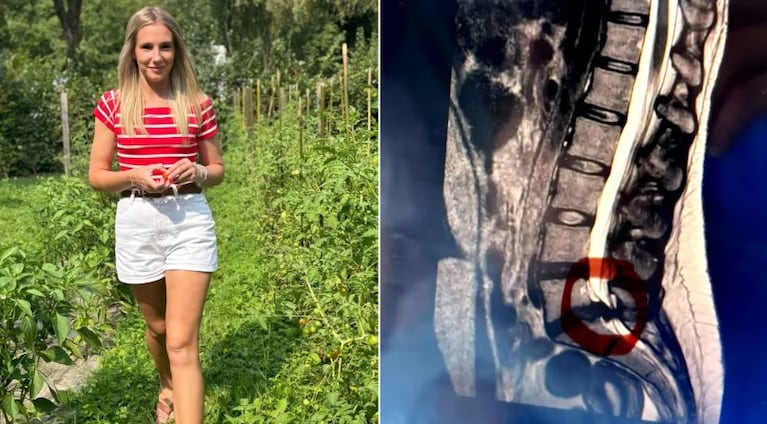 La mujer de 34 años estuvo semanas sin saber su diagnóstico.